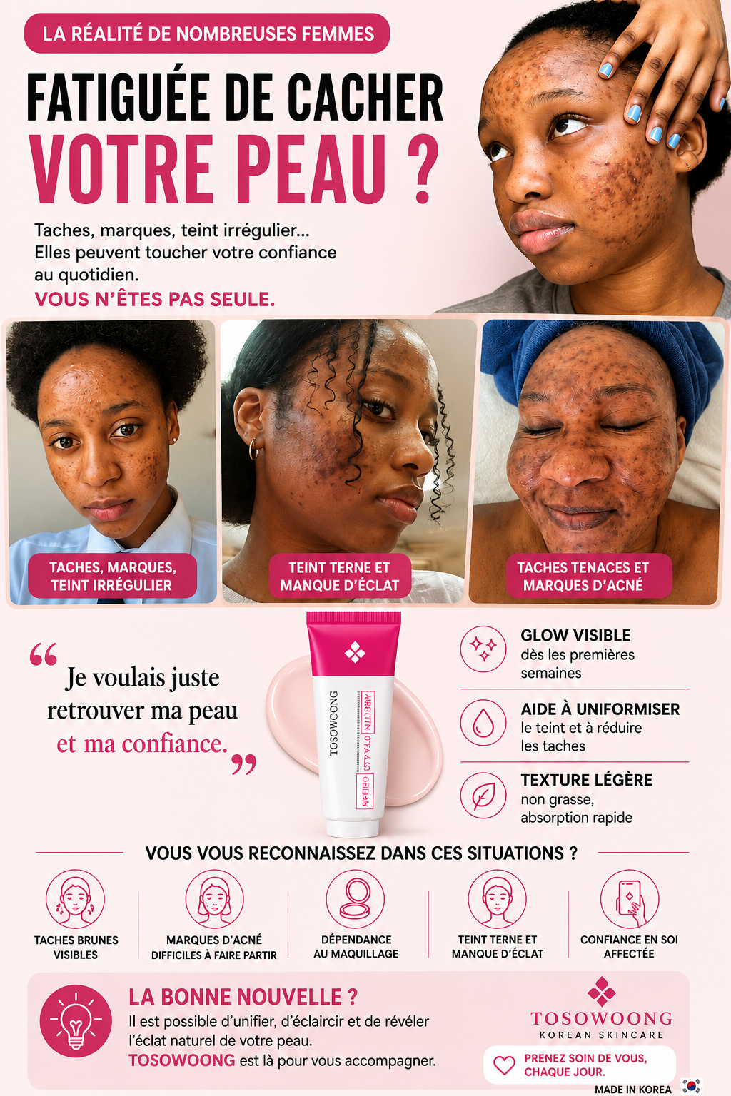 5 astuces pour effacer les taches du visage naturellement